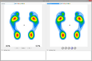 Picture showing how a user can view two foot scans from different times for historical reviews and comparisons